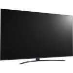 LED-телевизор LG 75UT81006LA (75